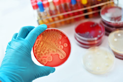 bacterial plating in microbiology lab